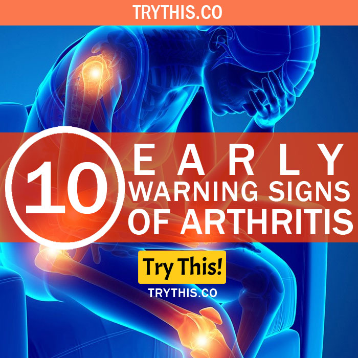 10 Early Warning Signs of Arthritis