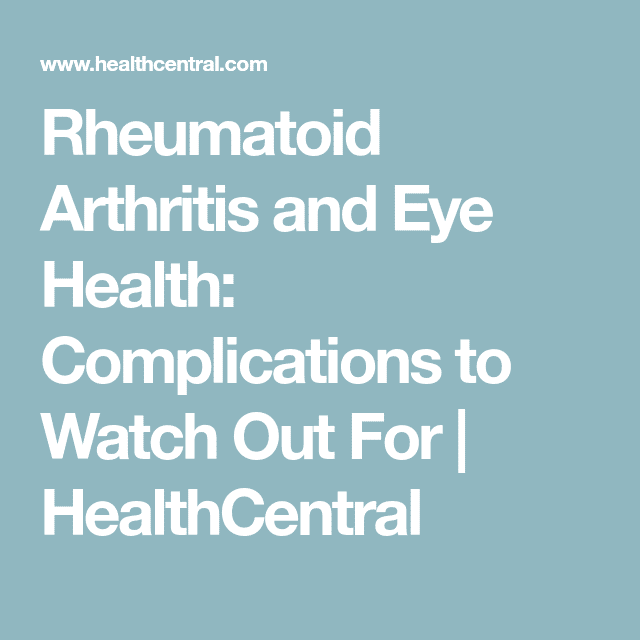 10 Surprising Ways Rheumatoid Arthritis Can Affect Your EyesAnd How to ...