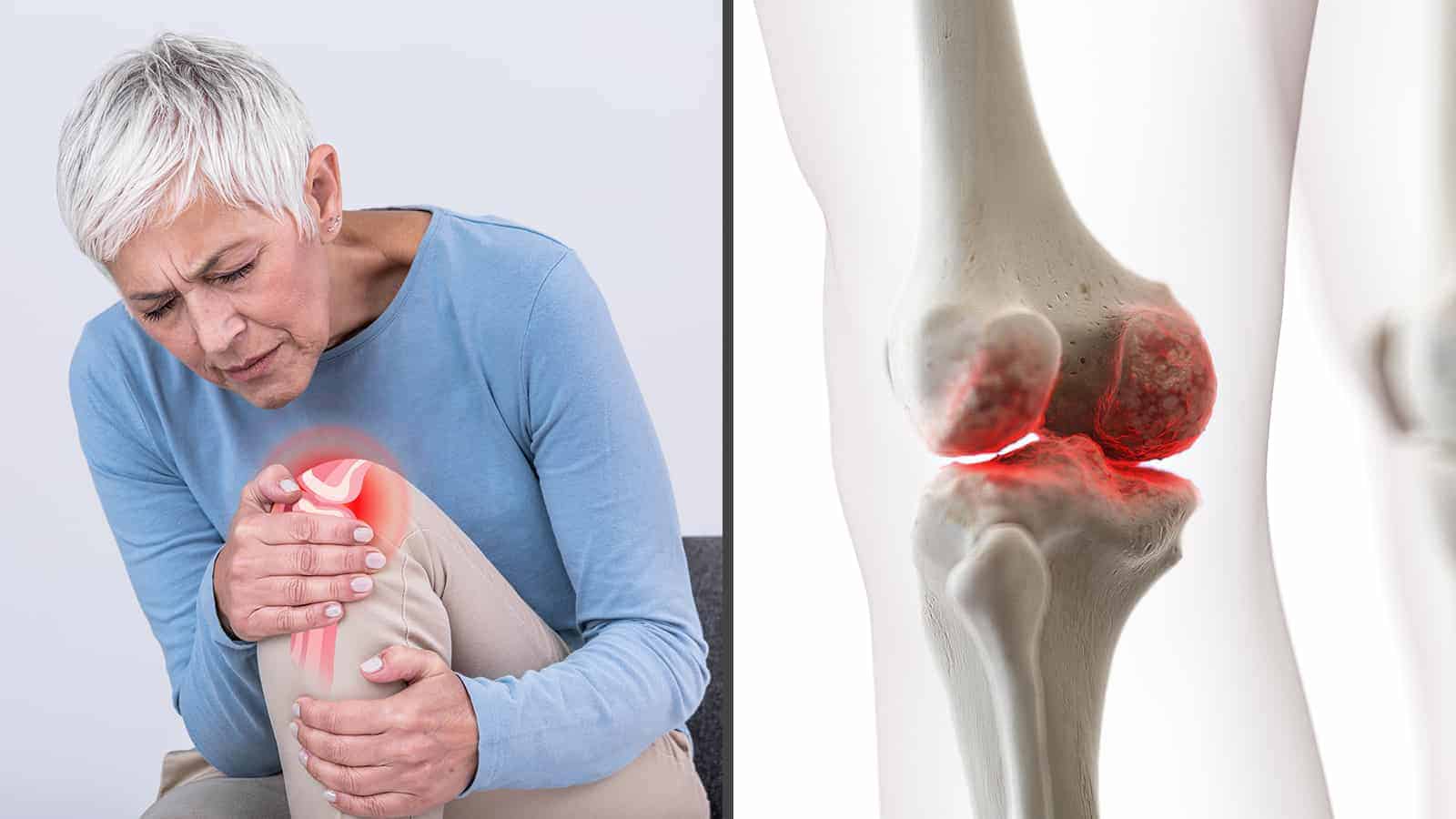 10 Ways to Relieve Arthritis Pain in Under 10 Minutes