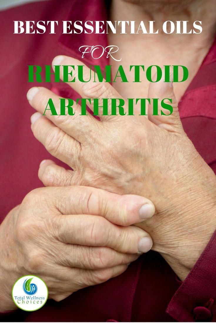 12 Best Essential Oils for Rheumatoid Arthritis. Learn how to relieve ...