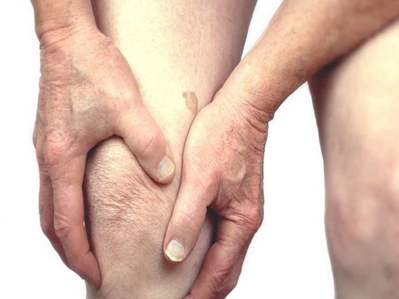 12 Rheumatoid Arthritis Signs and Symptoms