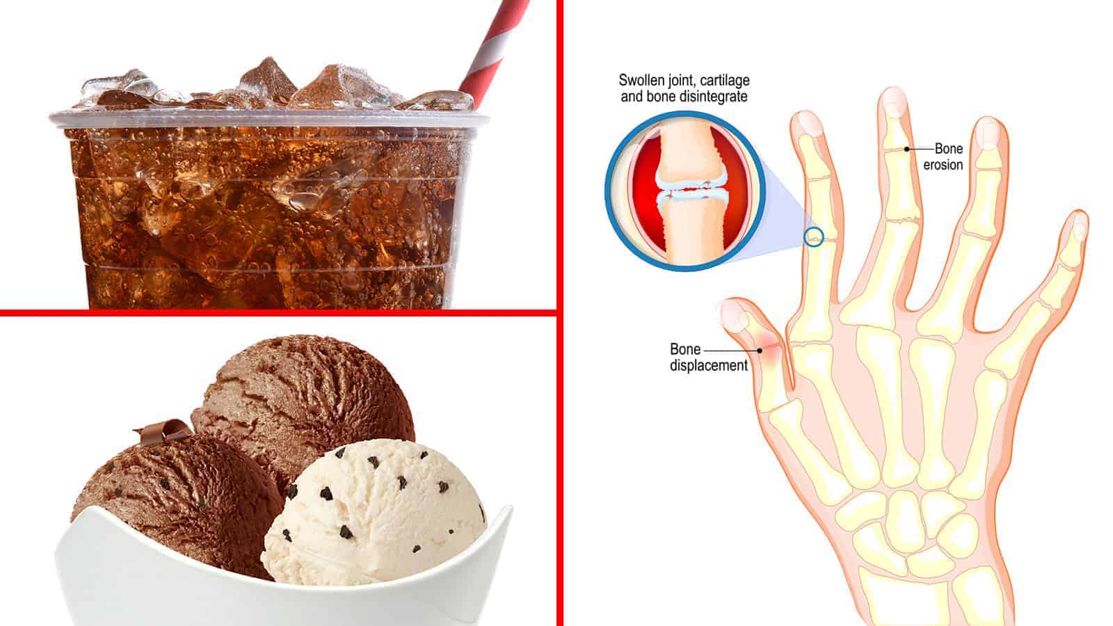 15 Foods That Arthritis Sufferers Should Avoid