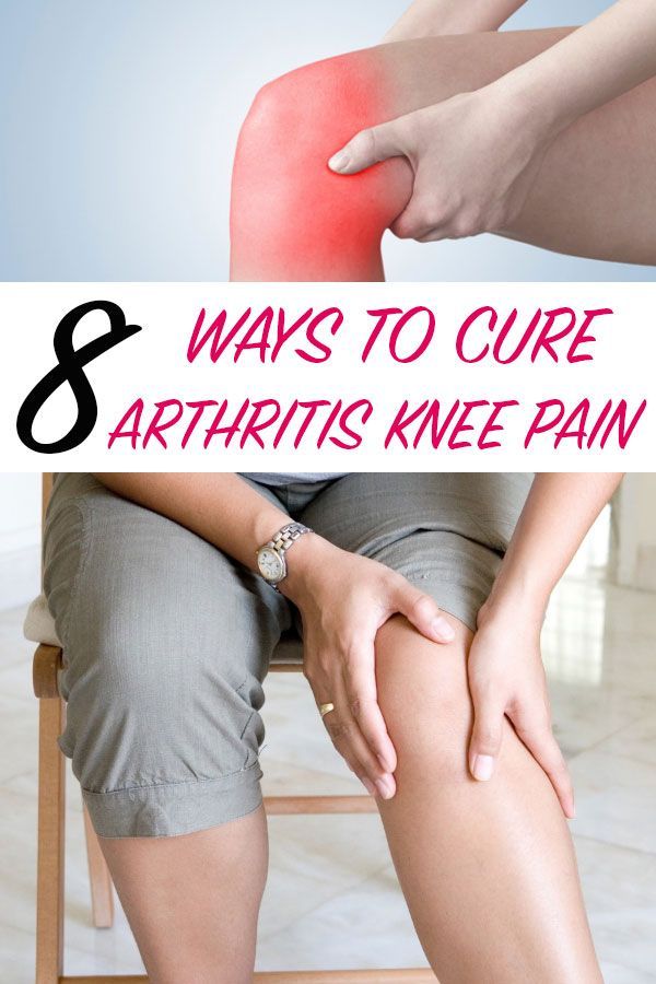 188 best images about Arthritis, Knee Pain &  Sciatica on Pinterest