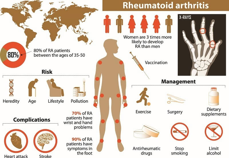 23 Early Symptoms For Rheumatoid Arthritis (CRUCIAL Advice)