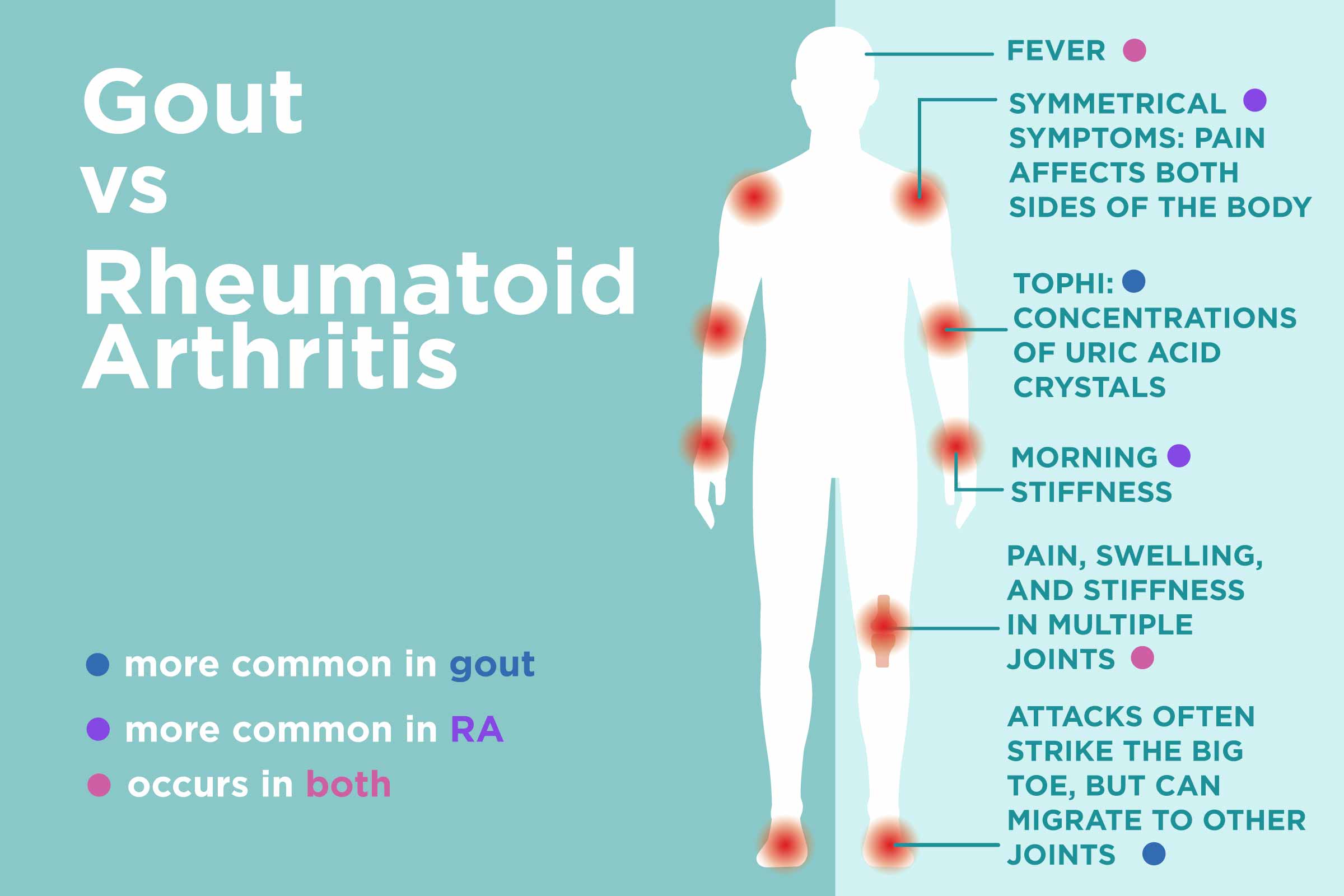 37+ How Common Is Rheumatoid Arthritis Background