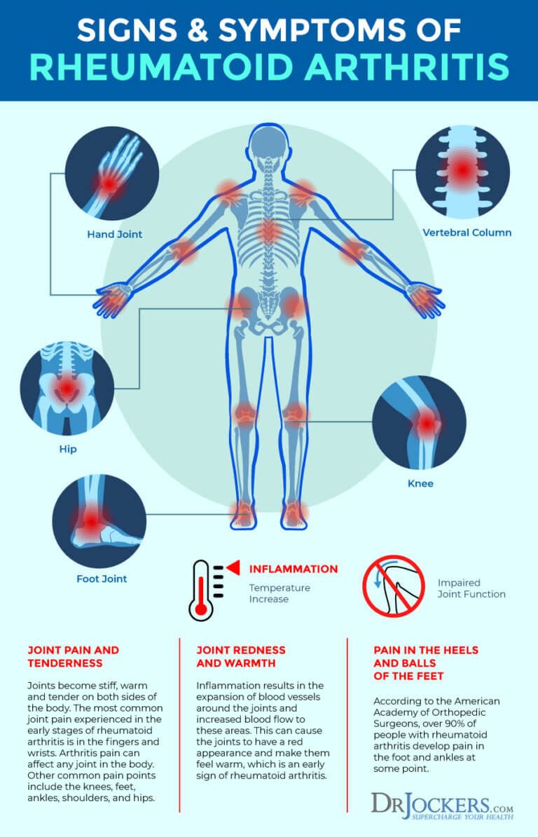 47+ Autoimmune Rheumatoid Arthritis Symptoms PNG ...