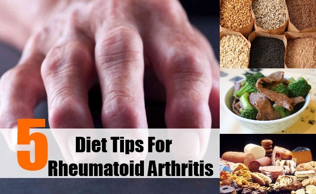 5 Best Diet Tips For Rheumatoid Arthritis