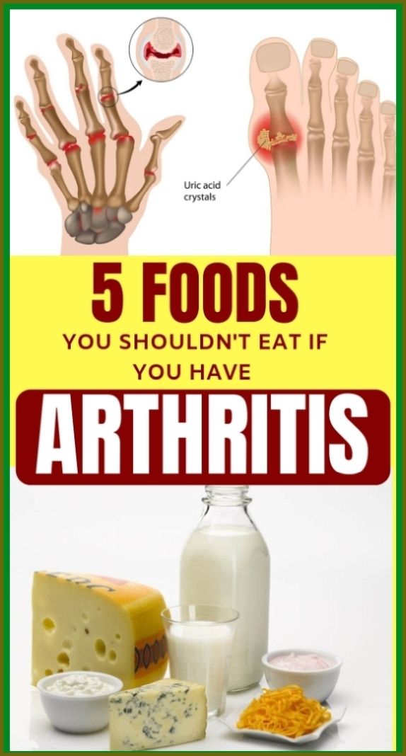 5 Foods You Should Never Eat If You Have Arthritis in 2020