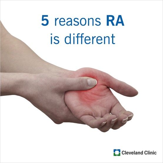 5 Ways Rheumatoid Arthritis is Different