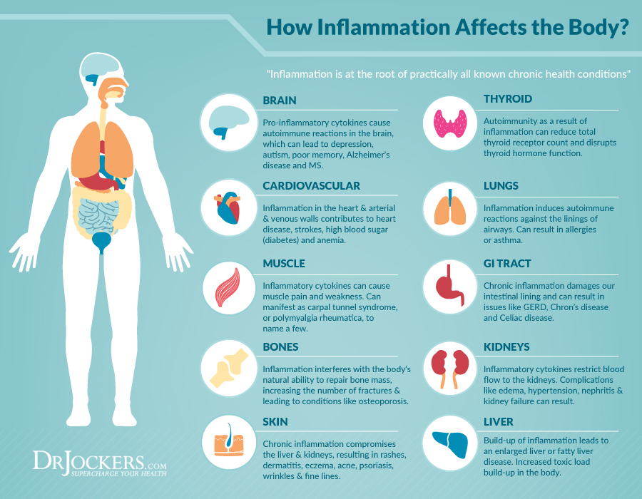 5 Ways To Reduce Inflammation Quickly