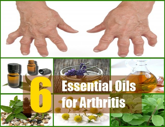 6 Aromatherapy Therapeutic Essential Oils For Arthritis ...