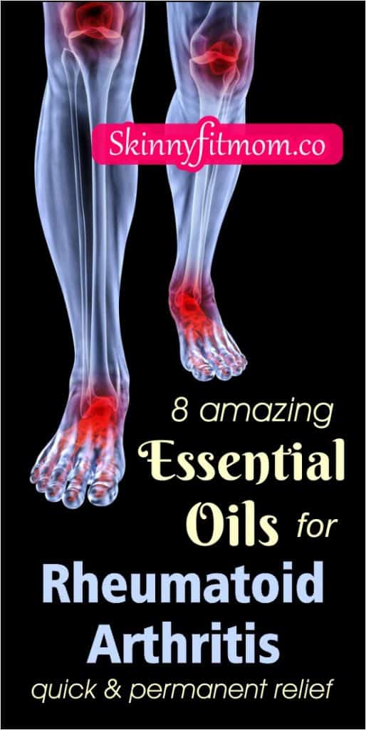 8 Best Essential Oils for Rheumatoid Arthritis Permanent Relief