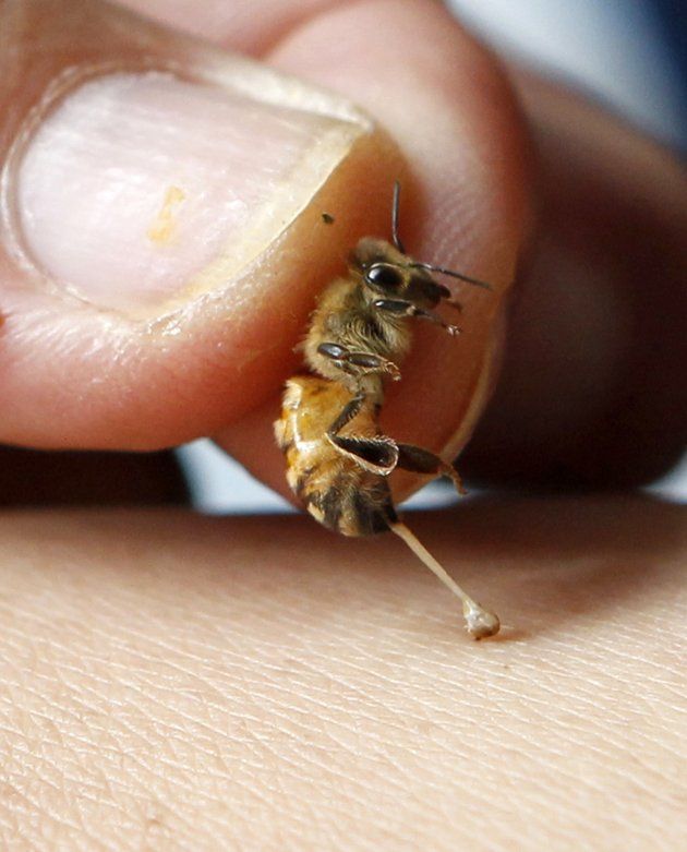 A bee sting therapist holds â¦