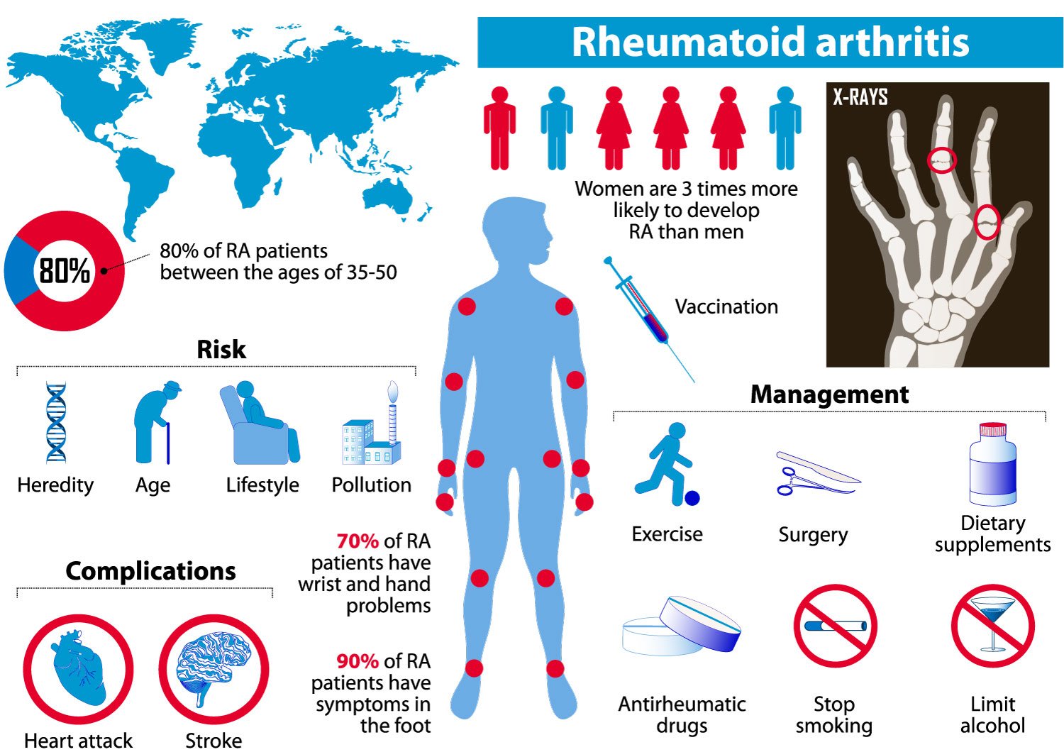 Artritis reumatoide y artrosis