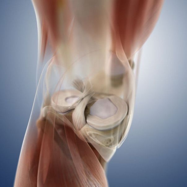 A meniscus tear is a common knee injury. Some require ...