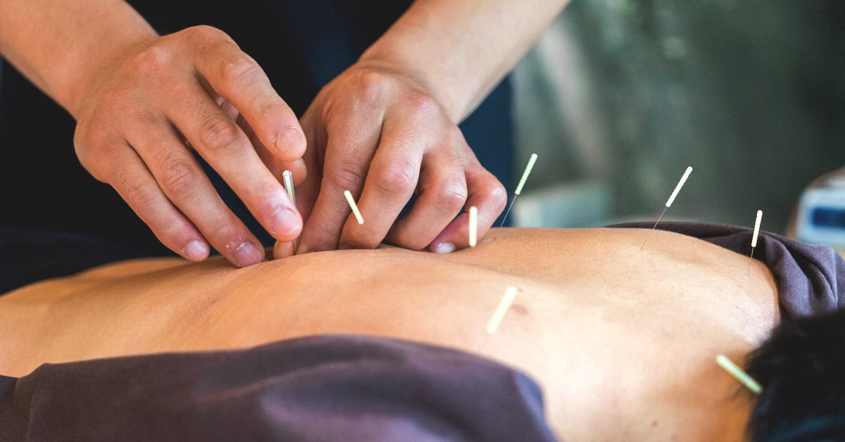 Acupuncture for Rheumatoid Arthritis: Benefits and Risks