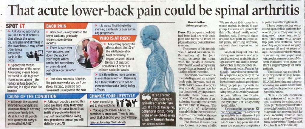 Acute Lower Back Pain Could be Spinal Arthritis