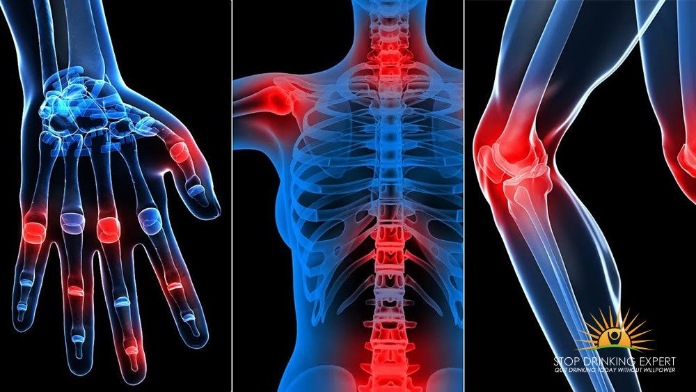 Alcohol and arthritis: Everything you wanted to know ...