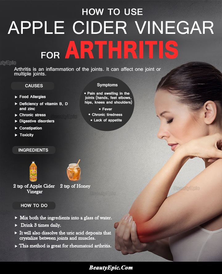 Apple Cider Vinegar for Arthritis Pain: How to Use?