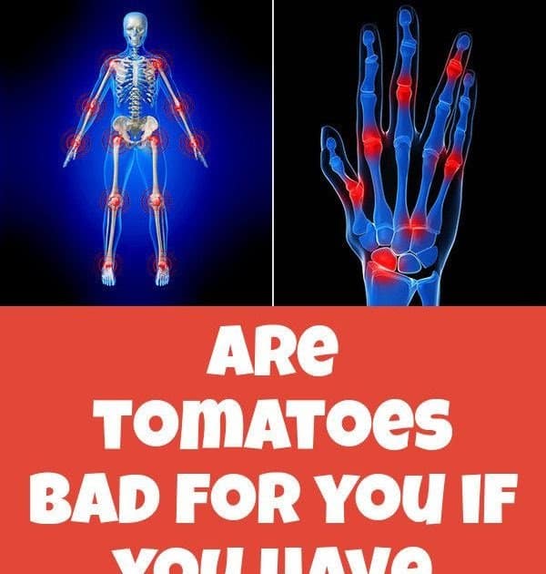 Are Tomatoes Bad For You If You Have Arthritis