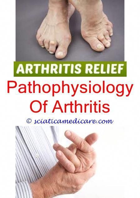 Arthritis and osteoporosis consultants of the carolinas ...