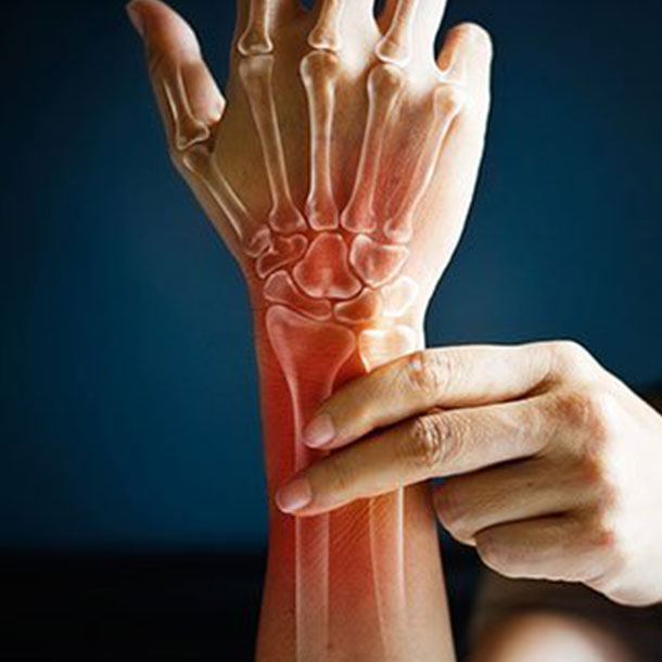 Arthritis: Causes and Treatment for Joint Stiffness and Pain