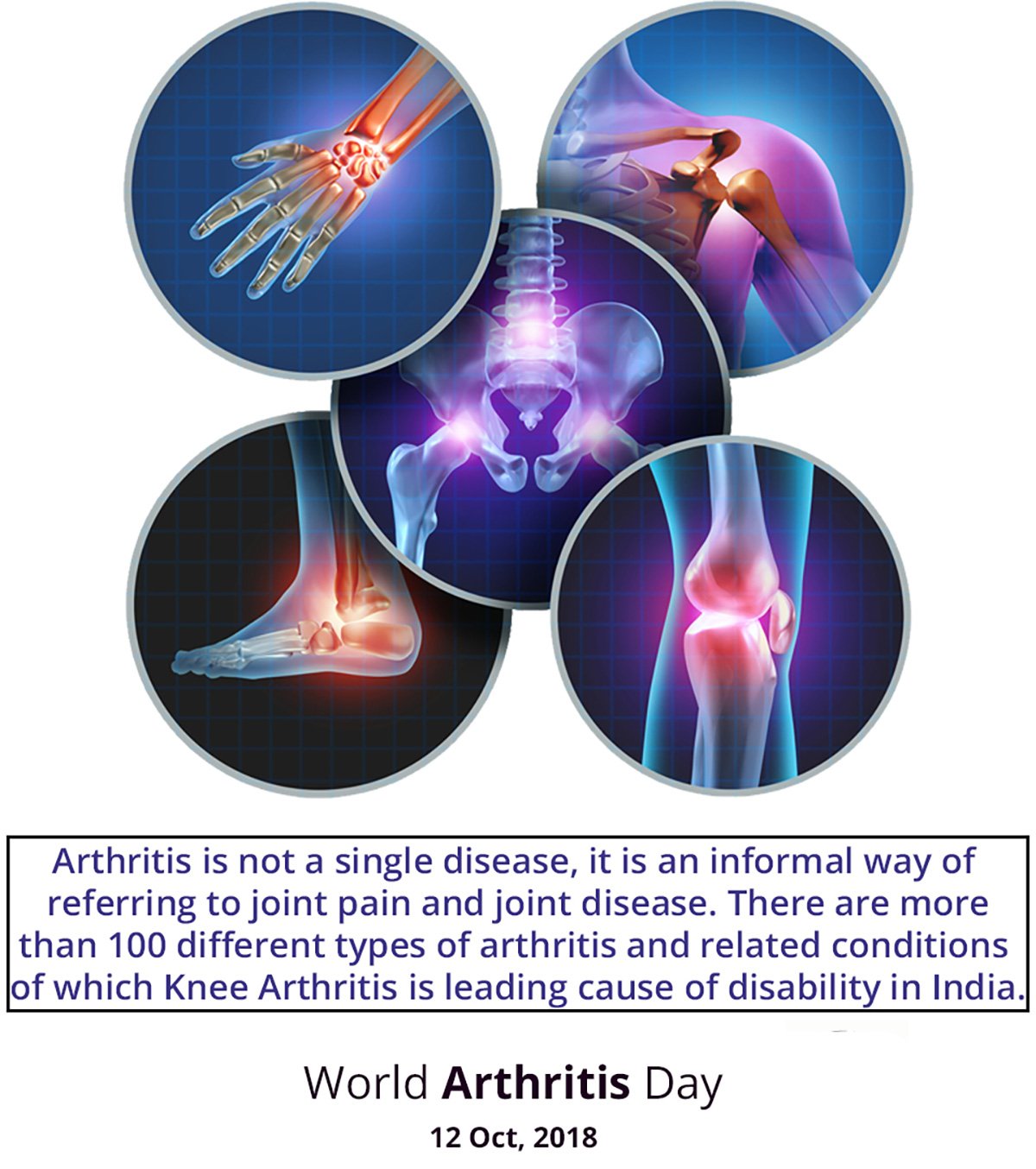 Arthritis Day 12th October 2021