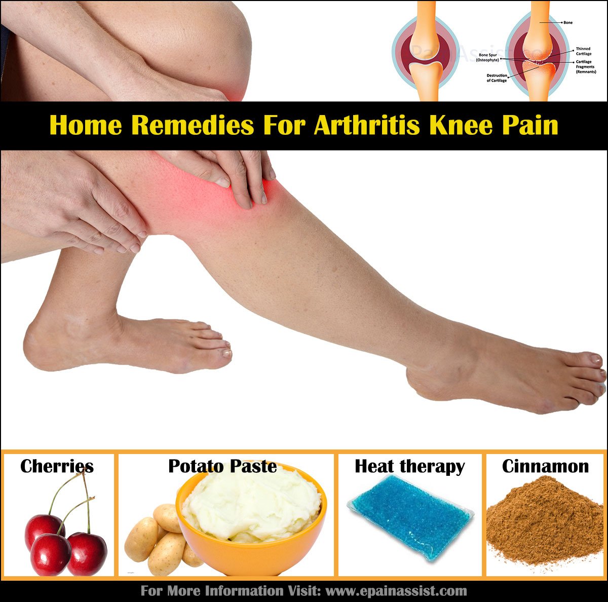 Arthritis Home Relief Remedies Is Spine For Cure ~ Namur ...