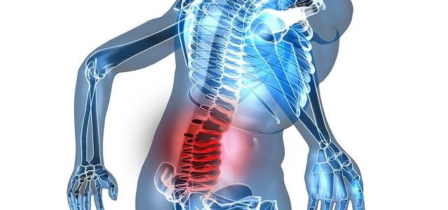 Arthritis In Back Pain Relief