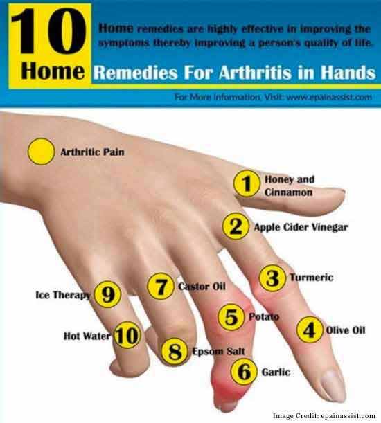 Arthritis In Hands â Why You Should Be Concerned