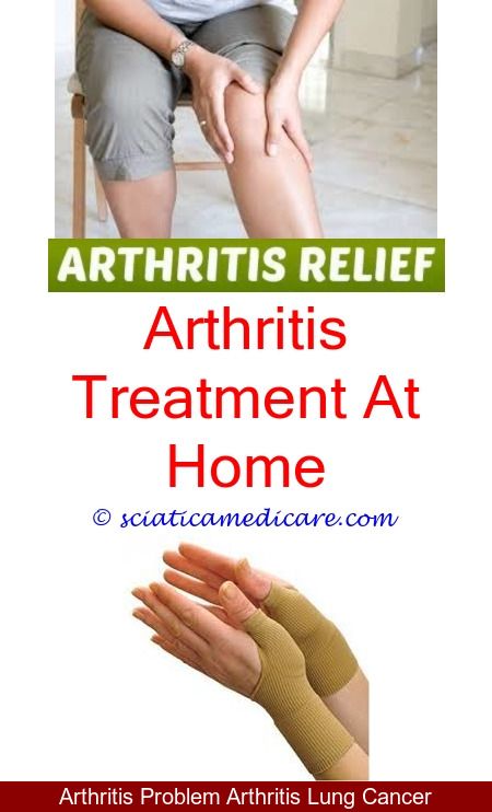 Arthritis In Knee