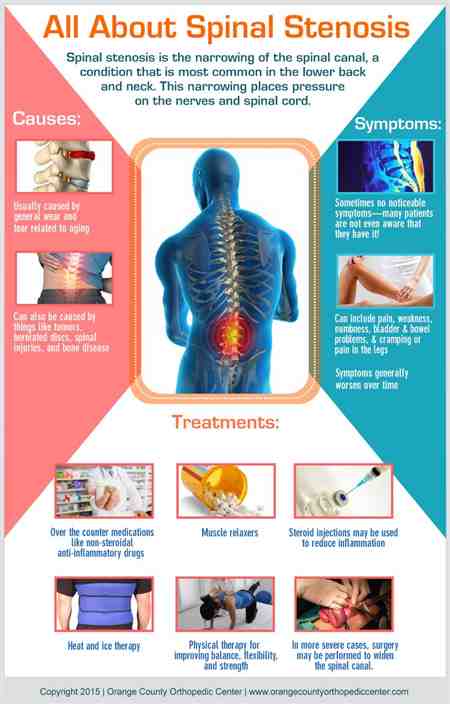 Arthritis Lumbar Spine Treatment For Gel Pain ...