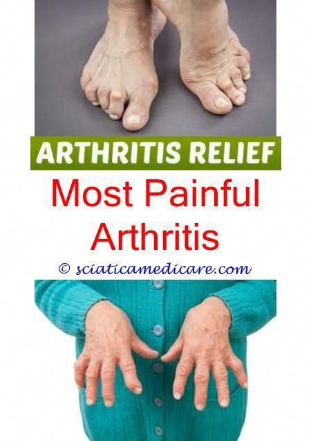 Arthritis nonsteroidal anti inflammatory drug.Oh my ...