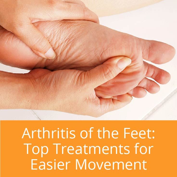 Arthritis of the Feet: Top 5 Treatments for Easier ...