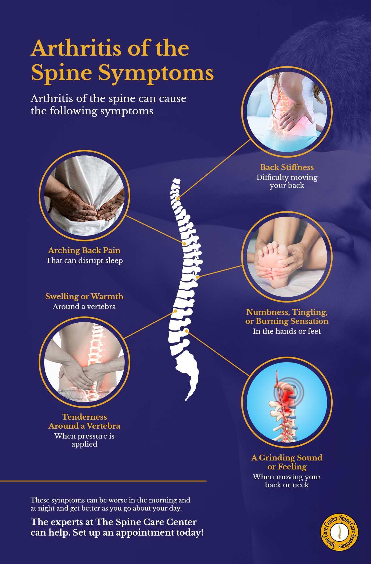 Arthritis Of The Spine