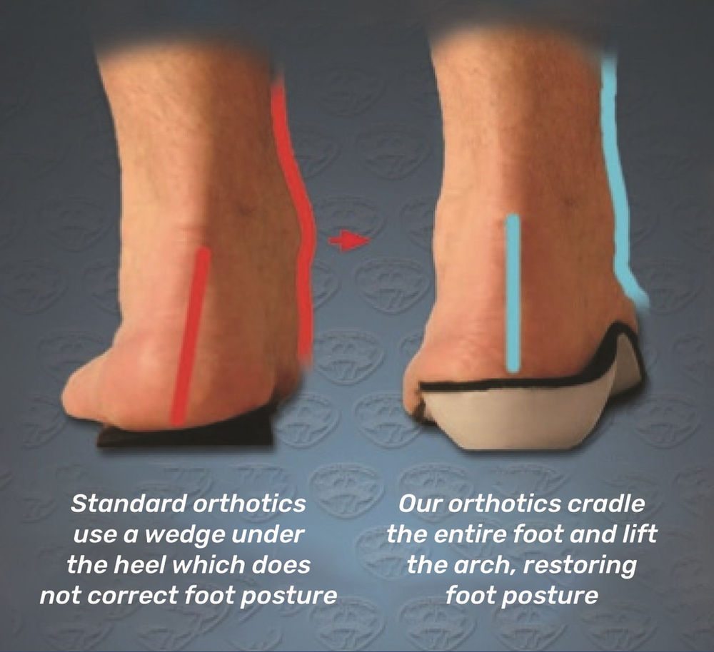 Arthritis Pain? Custom Orthotic Foot &  Arch Supportive Insoles Can Help!