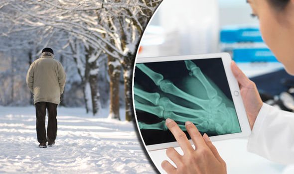 Arthritis pain: Does cold weather make symptoms worse ...