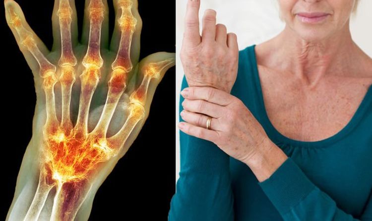 Arthritis pain: Symptoms and signs of the joint pain condition include ...
