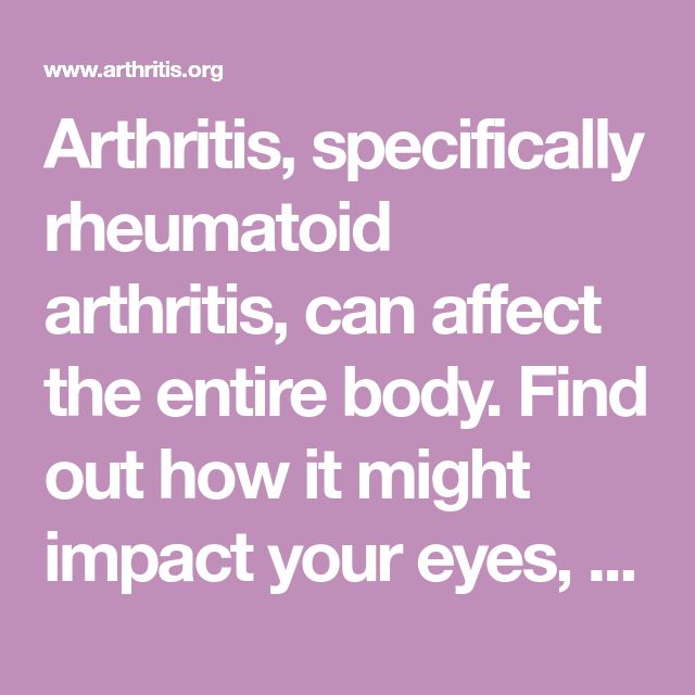 Arthritis, specifically rheumatoid arthritis, can affect the entire ...