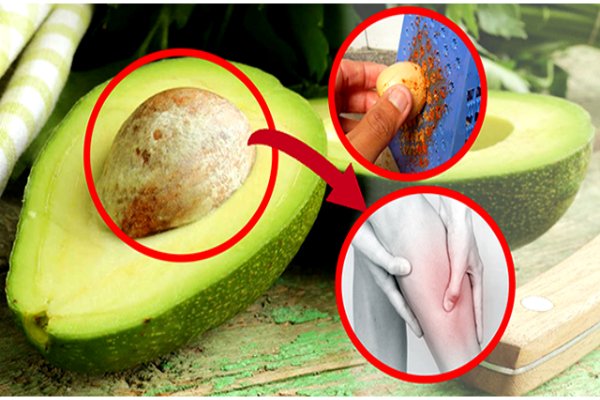 Avocado Benefits and Side Effects
