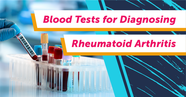 Blood Tests for Diagnosing Rheumatoid Arthritis