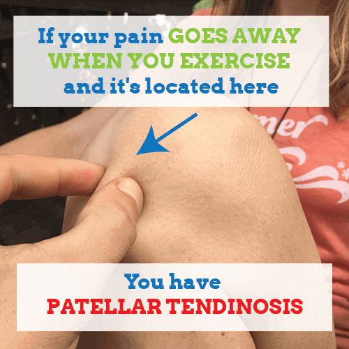 " But my pain goes away when I exercise?"  All About Tendinosis