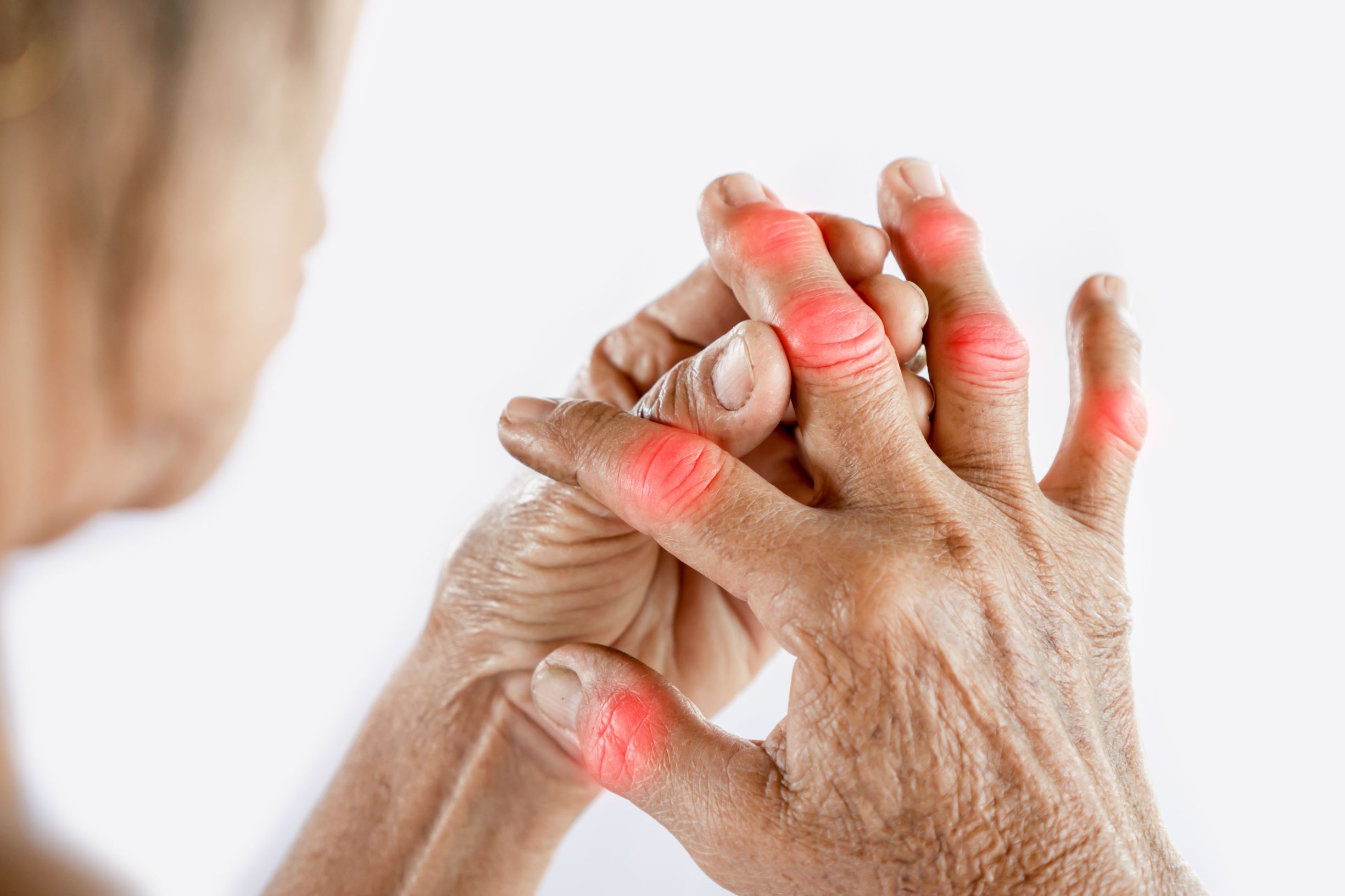 Can I Use CBD Balm For Pain Relief, Arthritis and Joint Pain?