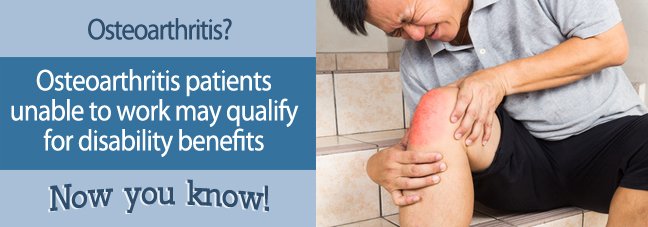 Can I Work With Osteoarthritis? Get a Free Case Evaluation ...