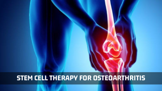 Can Osteoarthritis Be Cured by Stem Cell Therapy?