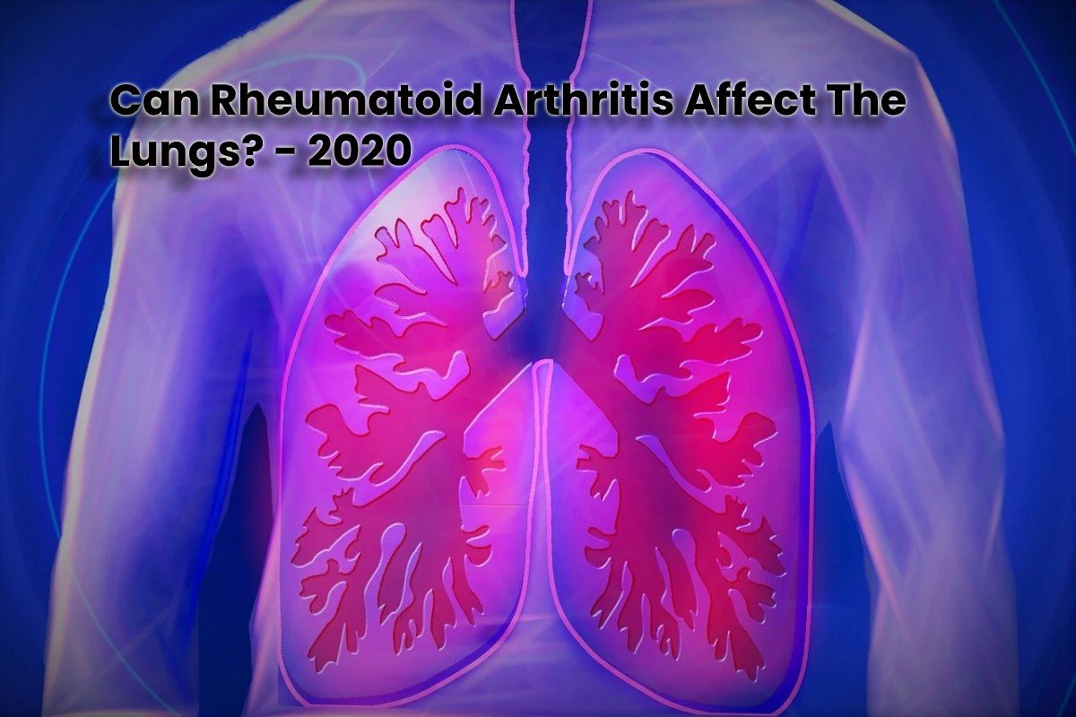 Can Rheumatoid Arthritis Affect The Lungs?