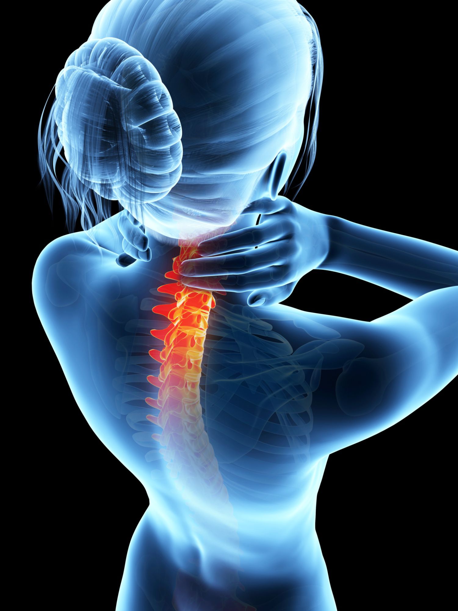 Can Rheumatoid Arthritis Affect the Spine?