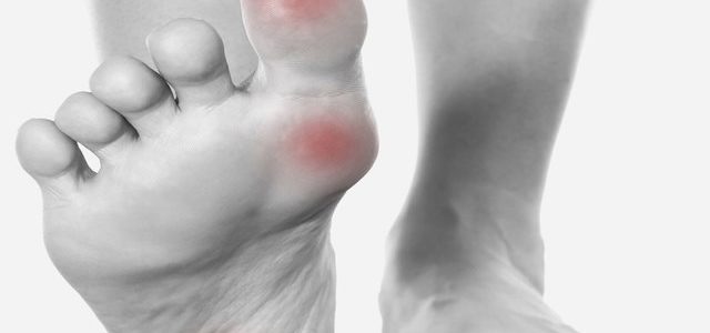 Can Rheumatoid Arthritis Cause Cold Feet