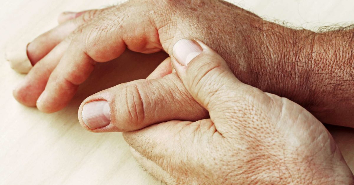 Can you die from rheumatoid arthritis? Lifespan and outlook