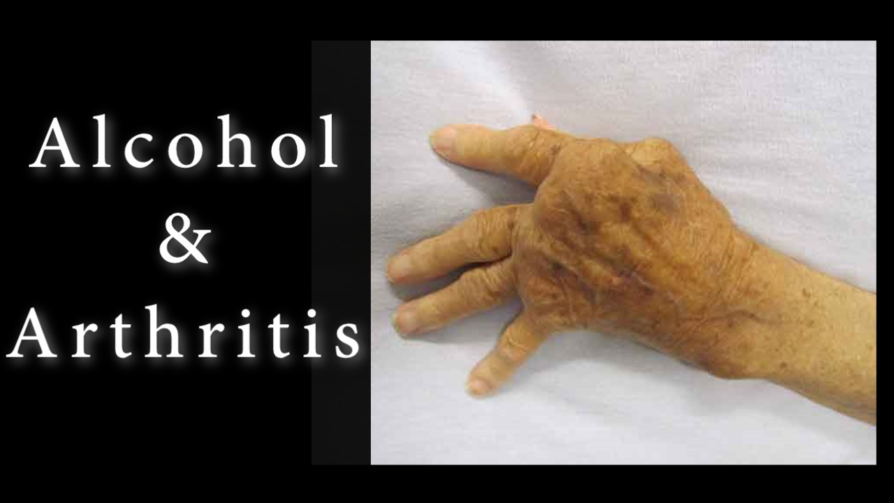 Can You Get Arthritis from Drinking Alcohol? What Can You ...
